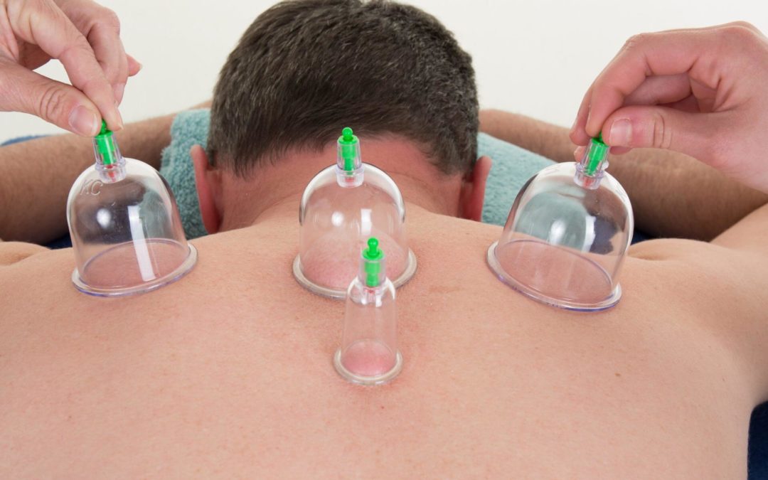 10 Things You Should Know About Hijama Cupping