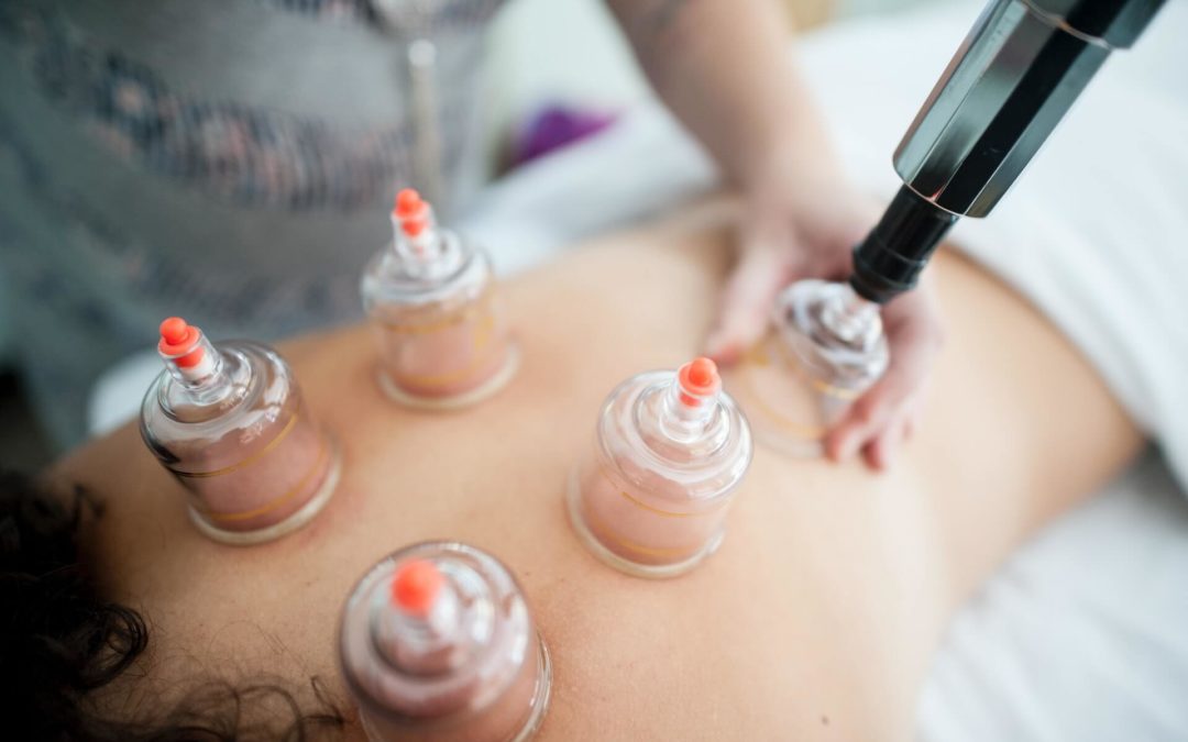 How Much Does Hijama Cost?