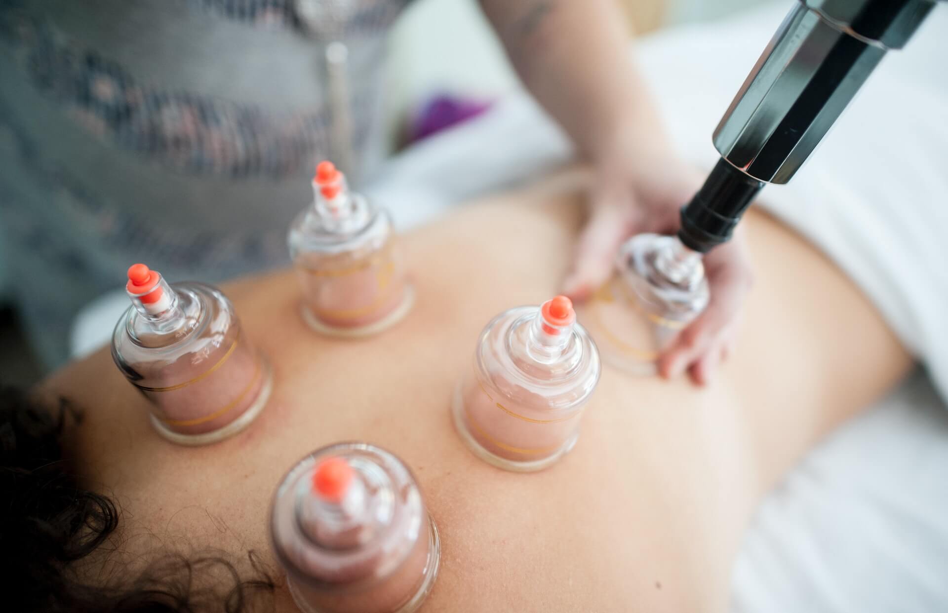 how much does hijama cost