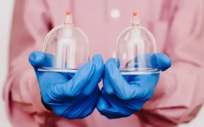 Hijama Cupping Sunnah Days 2026